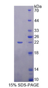 SHBG Protein - Recombinant  Sex Hormone Binding Globulin By SDS-PAGE