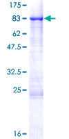 SHC3 / SHCC Protein - 12.5% SDS-PAGE of human SHC3 stained with Coomassie Blue