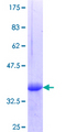SHC3 / SHCC Protein - 12.5% SDS-PAGE Stained with Coomassie Blue.