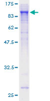 SHC4 Protein - 12.5% SDS-PAGE of human RaLP stained with Coomassie Blue