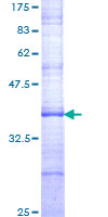SHFM3 / FBXW4 Protein - 12.5% SDS-PAGE Stained with Coomassie Blue.