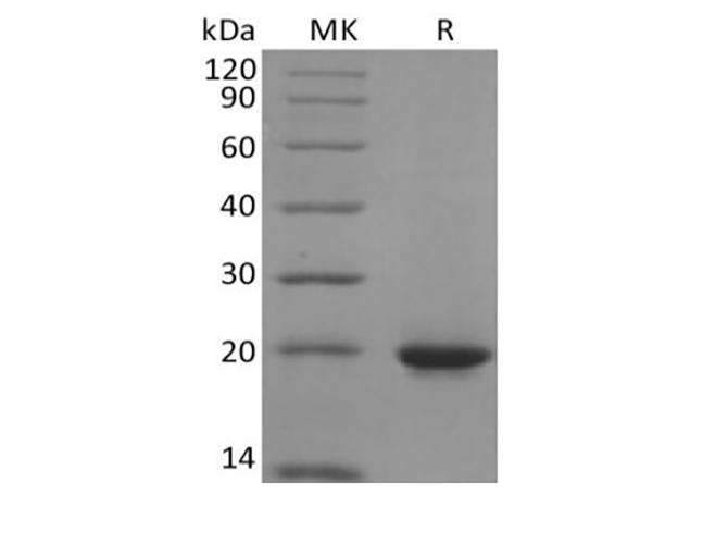 SHH / Sonic Hedgehog Protein - Recombinant Human Sonic Hedgehog/SHH (C-6His)