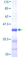 SHH / Sonic Hedgehog Protein - 12.5% SDS-PAGE Stained with Coomassie Blue.