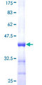 SHH / Sonic Hedgehog Protein - 12.5% SDS-PAGE Stained with Coomassie Blue.