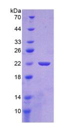 SHH / Sonic Hedgehog Protein - Recombinant Hedgehog Homolog, Sonic By SDS-PAGE