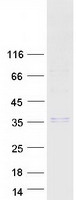 SHH / Sonic Hedgehog Protein - Purified recombinant protein SHH was analyzed by SDS-PAGE gel and Coomassie Blue Staining