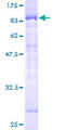 SHOC2 Protein - 12.5% SDS-PAGE of human SHOC2 stained with Coomassie Blue