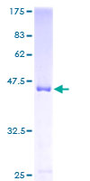 SHOOTIN1 / KIAA1598 Protein - 12.5% SDS-PAGE of human KIAA1598 stained with Coomassie Blue