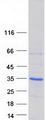 SHOX Protein - Purified recombinant protein SHOX was analyzed by SDS-PAGE gel and Coomassie Blue Staining