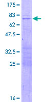 SHOX2 Protein - 12.5% SDS-PAGE of human SHOX2 stained with Coomassie Blue
