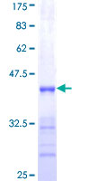 SHOX2 Protein - 12.5% SDS-PAGE Stained with Coomassie Blue.
