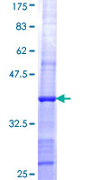 SHPRH Protein - 12.5% SDS-PAGE Stained with Coomassie Blue.