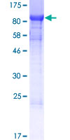 SHQ1 Protein - 12.5% SDS-PAGE of human SHQ1 stained with Coomassie Blue