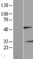 SHSF1 / SHFM1 Protein - Western validation with an anti-DDK antibody * L: Control HEK293 lysate R: Over-expression lysate