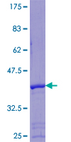 SHSF1 / SHFM1 Protein - 12.5% SDS-PAGE of human SHFM1 stained with Coomassie Blue