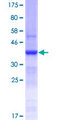 SI / Sucrase Isomaltase Protein - 12.5% SDS-PAGE Stained with Coomassie Blue.