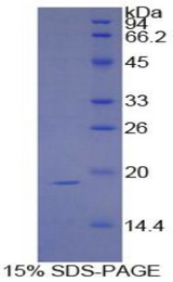 SI / Sucrase Isomaltase Protein - Recombinant Sucrase Isomaltase By SDS-PAGE