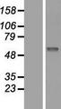 SIAE Protein - Western validation with an anti-DDK antibody * L: Control HEK293 lysate R: Over-expression lysate