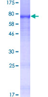 SIAE Protein - 12.5% SDS-PAGE of human SIAE stained with Coomassie Blue