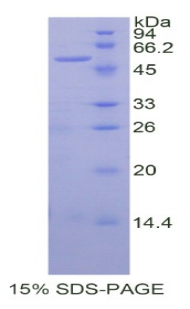SIAE Protein - Recombinant Sialic Acid Acetylesterase By SDS-PAGE
