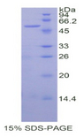 SIAE Protein - Recombinant Sialic Acid Acetylesterase By SDS-PAGE