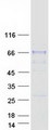 SIAE Protein - Purified recombinant protein SIAE was analyzed by SDS-PAGE gel and Coomassie Blue Staining