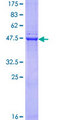 SIAH1 Protein - 12.5% SDS-PAGE of human SIAH1 stained with Coomassie Blue
