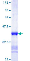 SIAH1 Protein - 12.5% SDS-PAGE Stained with Coomassie Blue.