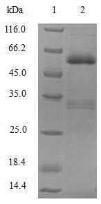 SIAH1 Protein - (Tris-Glycine gel) Discontinuous SDS-PAGE (reduced) with 5% enrichment gel and 15% separation gel.