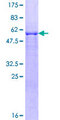 SIAH2 Protein - 12.5% SDS-PAGE of human SIAH2 stained with Coomassie Blue