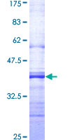 SIAH2 Protein - 12.5% SDS-PAGE Stained with Coomassie Blue.