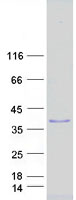 SIAH2 Protein - Purified recombinant protein SIAH2 was analyzed by SDS-PAGE gel and Coomassie Blue Staining