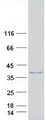 SIAH2 Protein - Purified recombinant protein SIAH2 was analyzed by SDS-PAGE gel and Coomassie Blue Staining