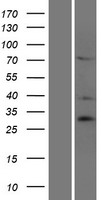 SIAH3 Protein - Western validation with an anti-DDK antibody * L: Control HEK293 lysate R: Over-expression lysate