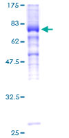 SIGIRR Protein - 12.5% SDS-PAGE of human SIGIRR stained with Coomassie Blue