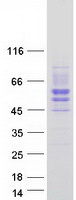 SIGIRR Protein - Purified recombinant protein SIGIRR was analyzed by SDS-PAGE gel and Coomassie Blue Staining