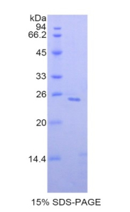 SIGLEC1 / CD169 / Sialoadhesin Protein