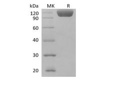 SIGLEC10 Protein - Recombinant Human Siglec-10 (C-Fc)