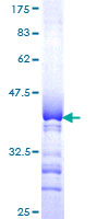 SIGLEC10 Protein - 12.5% SDS-PAGE Stained with Coomassie Blue.