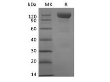 SIGLEC10 Protein - Recombinant Human Siglec-10 (C-mFc)