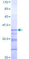 SIGLEC12 Protein - 12.5% SDS-PAGE Stained with Coomassie Blue.