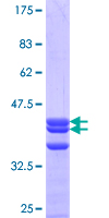 SIGLEC12 Protein - 12.5% SDS-PAGE Stained with Coomassie Blue.
