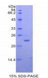SIGLEC12 Protein - Recombinant Sialic Acid Binding Ig Like Lectin 12 By SDS-PAGE