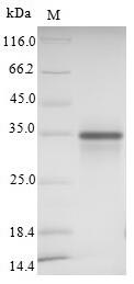 SIGLEC15 Protein - (Tris-Glycine gel) Discontinuous SDS-PAGE (reduced) with 5% enrichment gel and 15% separation gel.