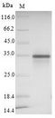 SIGLEC15 Protein - (Tris-Glycine gel) Discontinuous SDS-PAGE (reduced) with 5% enrichment gel and 15% separation gel.