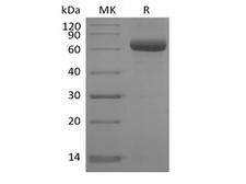 SIGLEC15 Protein - Recombinant Human Sialic acid-binding Ig-like lectin 15/Siglec-15/CD33L3 (C-FC-Avi) Biotinylated