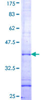 SIGLEC5 / CD170 Protein - 12.5% SDS-PAGE Stained with Coomassie Blue.