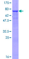 SIGLEC6 Protein - 12.5% SDS-PAGE of human SIGLEC6 stained with Coomassie Blue