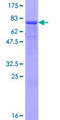 SIGLEC6 Protein - 12.5% SDS-PAGE of human SIGLEC6 stained with Coomassie Blue