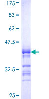 SIGLEC6 Protein - 12.5% SDS-PAGE Stained with Coomassie Blue.